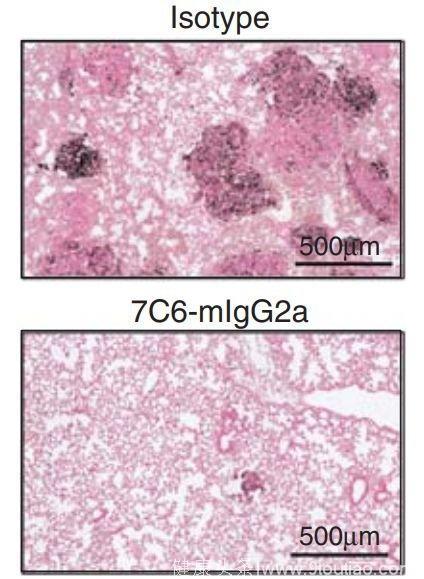 Science重要成果：癌症免疫疗法新突破——NK细胞抗癌实力被证实！