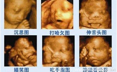 怀孕26周做四维彩超，看到彩超里的宝宝，瞬间被医生臭骂一顿