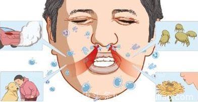 治过敏性鼻炎 调和脏腑是根本