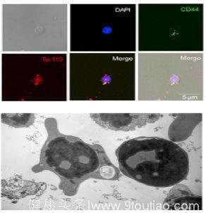 曹雪涛院士团队再获重大突破：新型红细胞亚群促进肝细胞癌进展