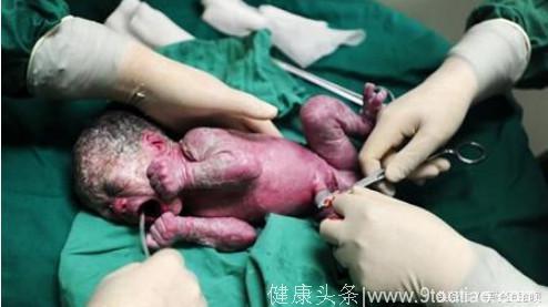 49岁孕妇怀孕超过预产期15天，医生划开肚子后，顿时被熏吐了！