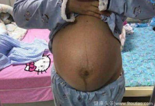 愚人节顺产诞下7斤大胖小子，老公很是意外，孕妈分享怀孕症状