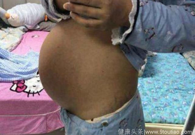 愚人节顺产诞下7斤大胖小子，老公很是意外，孕妈分享怀孕症状