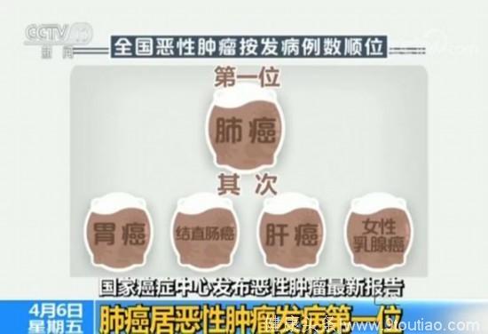 国家癌症中心：中国平均每分钟7人确诊患癌4人死亡，肺癌居首