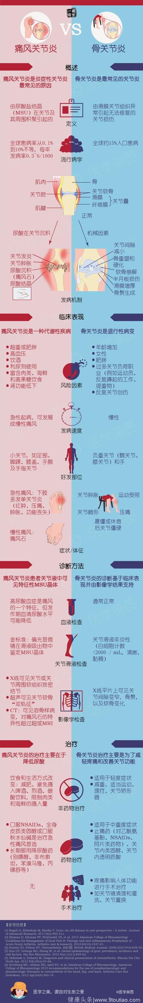 痛风关节炎与骨关节炎有区别吗|十跖·一图读懂