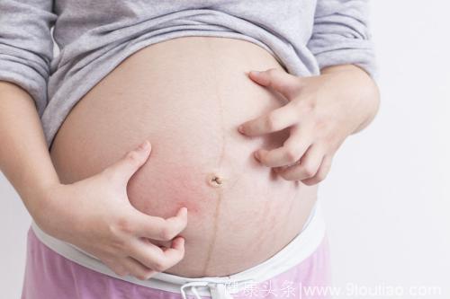怀孕期间肚皮发痒，为什么不能用马三立的偏方“挠挠”？