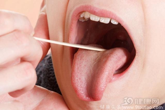 舌癌现身前，身体总有这4种不适！发现一定不能拖