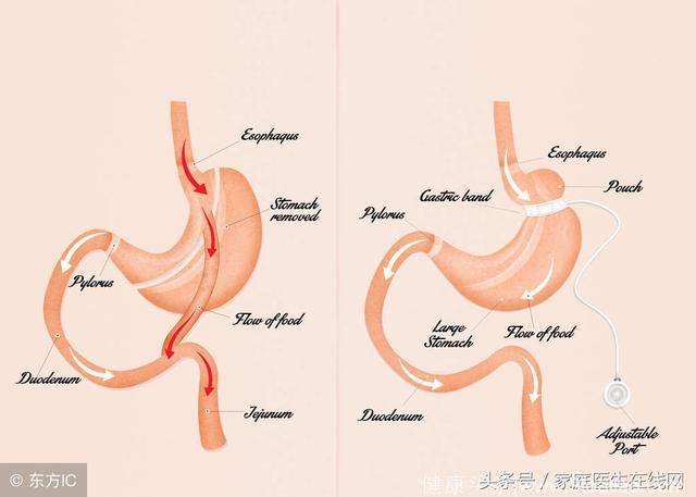 这4种食物是胃黏膜的“修复器”，常吃养出健康胃