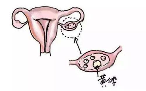 导致子宫内膜增生的原因有哪些 该怎么治疗好呢