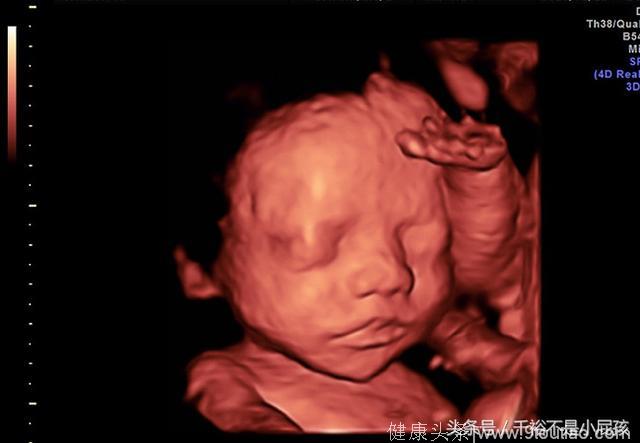 怀孕24周去医院做四维，医生看到宝宝表情后，痛骂孕妈不自爱