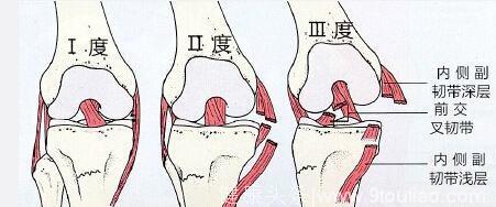 如何保养膝关节？