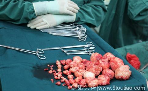 牟平区中医医院：妇科团队成功为一患者切除70余枚子宫肌瘤并保留子宫