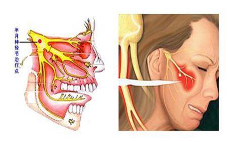 颈椎病容易被忽视的症状：胸闷、牙疼、眼睛疲劳，这些你知道吗？