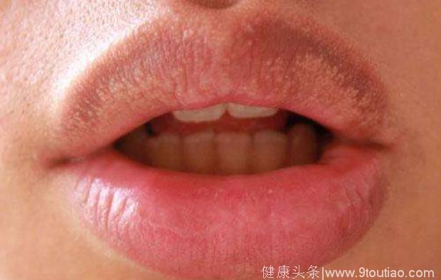 心理测试：4张嘴唇，哪个是男人的？测你能吸引来哪种档次的异性