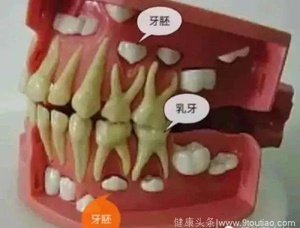 儿童换牙期需注意