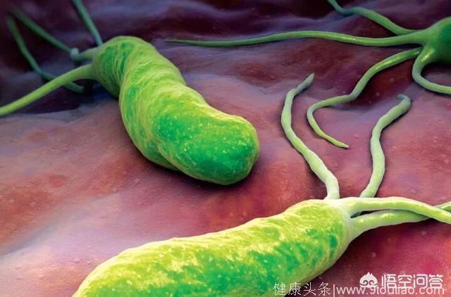 食疗能消灭幽门螺旋杆菌吗？