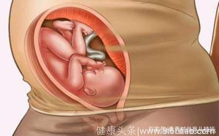 孕期孕妈的这2个行为容易引起胎位不正，伤胎又伤身，要及时纠正