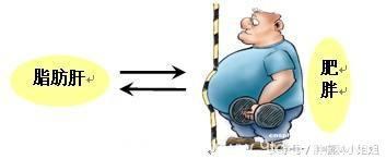 脂肪肝的人群你知道如何“减肥”吗？