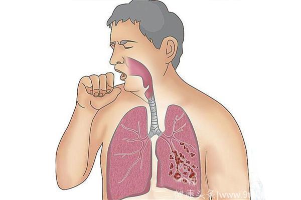 不见喘的哮喘是什么哮喘，它严重吗？