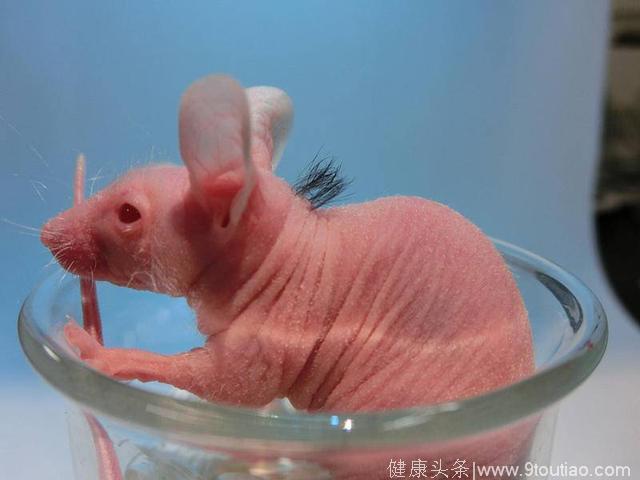 日本突破毛囊移植技术，一个细胞培养1万根头发，脱发者迎第二春