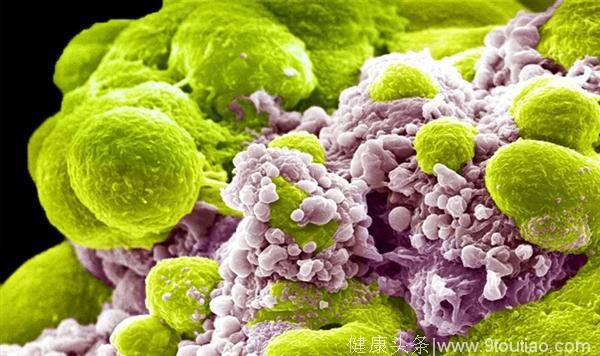 打击恶性肿瘤形成前的“蛰伏细胞”：如何将癌症杀死在摇篮里