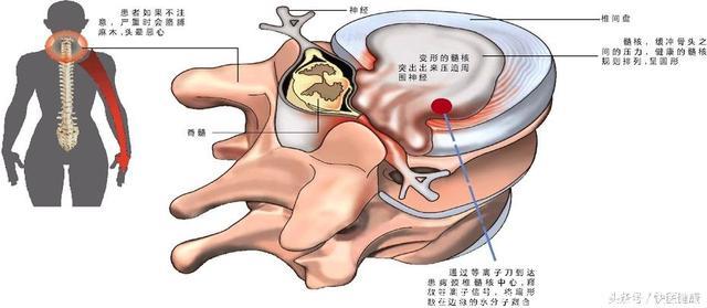 颈椎酸疼难忍，一个小方法就能治，轻松缓解颈椎疼痛！