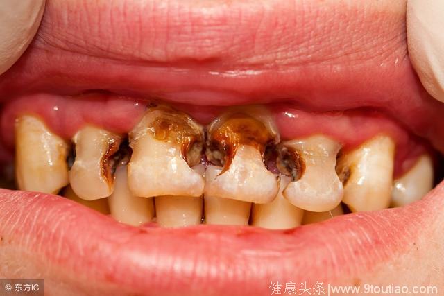 天天刷牙，牙齿依旧发黄，甚至还有口臭，常吃这5类食物轻松缓解