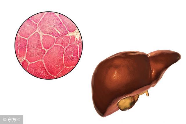 这3种行为太伤肝，4种食物，让你轻松养出好肝脏