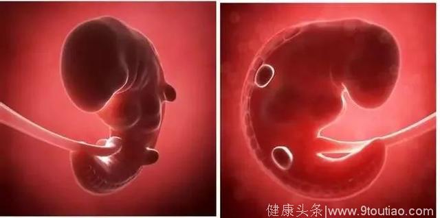 胚胎停止发育可以早知道吗？