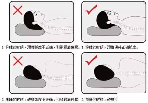 颈椎病与落枕的区别到底有哪些？落枕了怎么按摩最有效？分享！