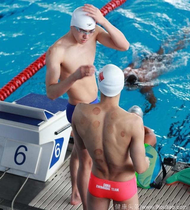 亚运会游泳选手热衷拔罐 中医秘方很流行