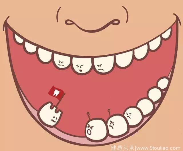 这个方法能预防60%以上的儿童蛀牙，WHO强烈推荐