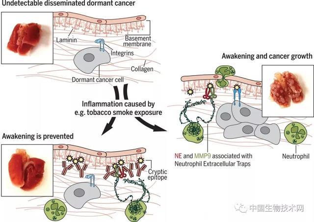 Science：是什么唤醒了休眠的癌细胞？