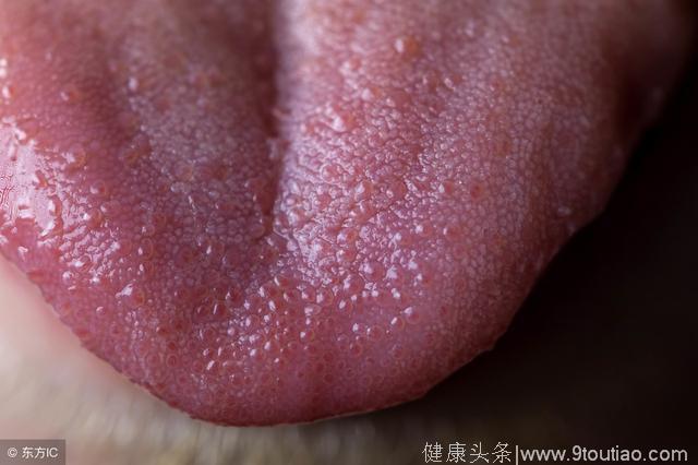 瘀血的舌象及淤血体质的食疗方法