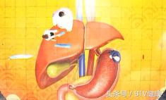 中日友好医院专家提醒：“轻度脂肪肝也会癌变”！