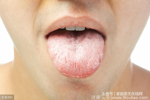 糖尿病人的舌头，慢慢有这3个异常，说明血糖在上升了