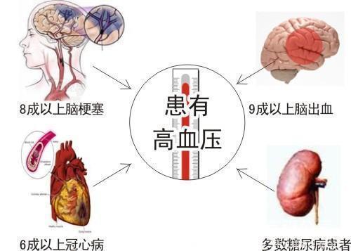 预防心血管病十大常见误区