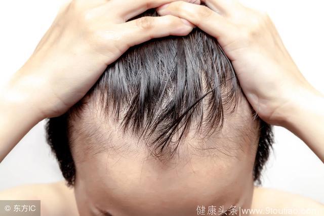 如何预防脱发？记住这6条！连男神——吴彦祖都脱发了！