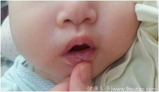 宝宝又哭又闹，嘴里还经常有白色的东西，宝宝究竟是怎么了？