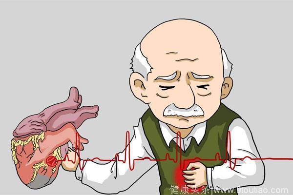 心脏搭桥、心脏支架有什么优缺点？冠心病患者到底该怎么选？