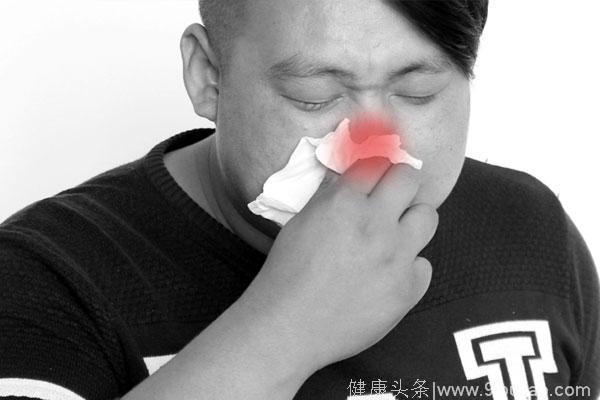 过敏性鼻炎应如何治疗？做好这3点，鼻炎可能慢慢远离你