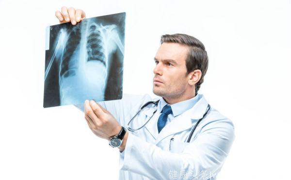 肺癌常常有四个标志，超过两个以上，提示癌症已经是进展期