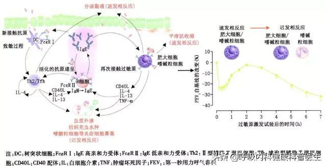 奥马珠单抗治疗过敏性哮喘的中国专家共识及真实临床应用经验分享