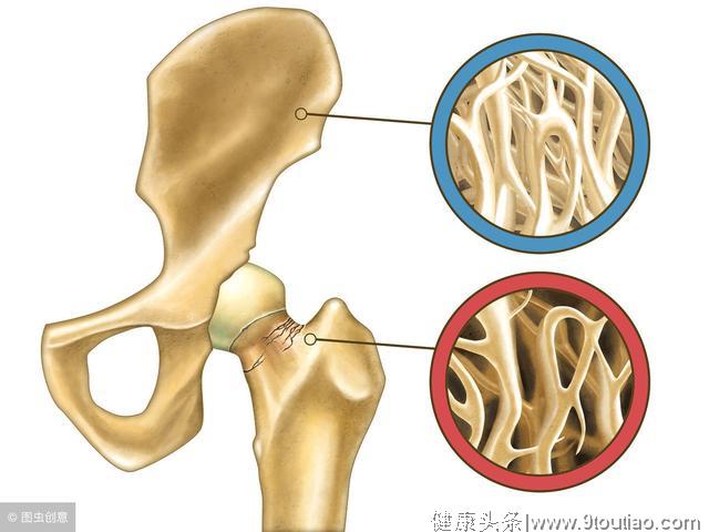 医生提醒：女性出现4这个症状，十有八九是更年期！别不当回事