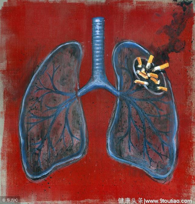 请远离香烟！“顽固性”癌症小细胞肺癌几乎是吸烟者专属疾病