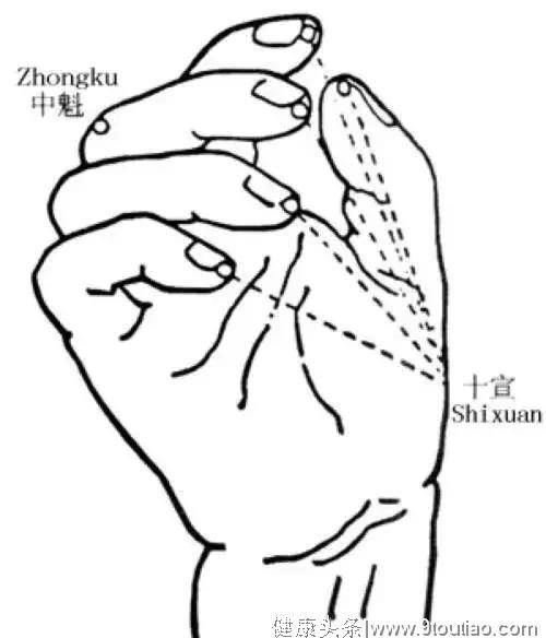 【取穴方法】仰掌,十指微屈微,十宣穴在手十指尖端,左右共10个穴位