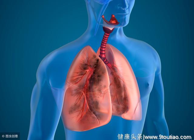 肺癌威胁国人健康教你五个招数预防它