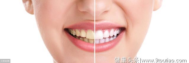 怎样把牙齿变的洁白光泽？