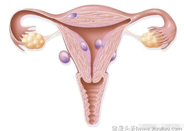 女人为什么会患上宫颈癌？对照自查一下，你是否做过这3件事！
