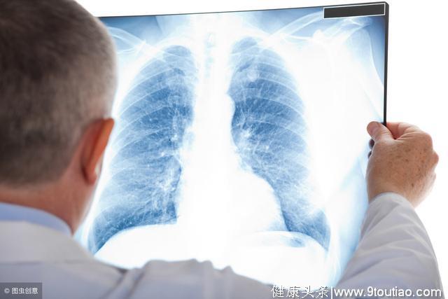 肺结节良恶性的判断大体需要三大方案